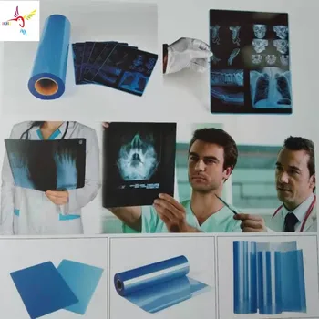 175 mikronos Kék Tintasugaras Orvosi Film EPSON CANON HP, meg mindenféle tintasugaras nyomtató használni, mint a röntgen CT CR DR. MR, PET-CT