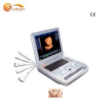 Orvosi Ultrahang Mindray Hordozható Ultrahang Echokardiográfia Mindray Szív Ultrahang
